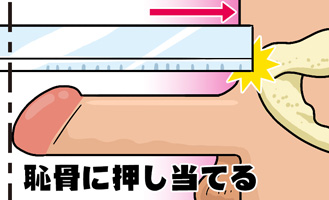 ペニスの長さを測る