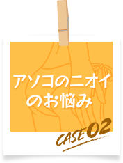 アソコのニオイのお悩み　case02