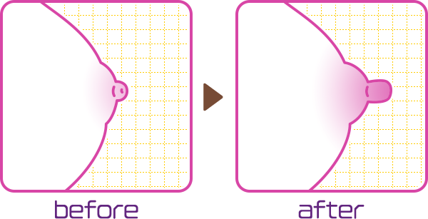 before→after